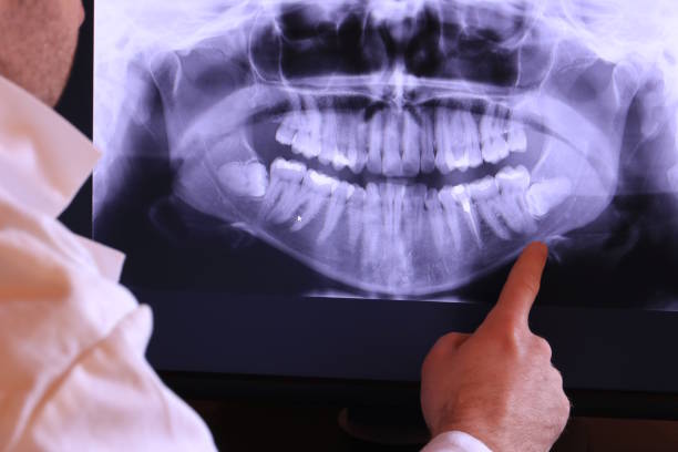 Emergency Dentist for Kids in OH
