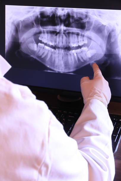Emergency Dental Filling Replacement in OH