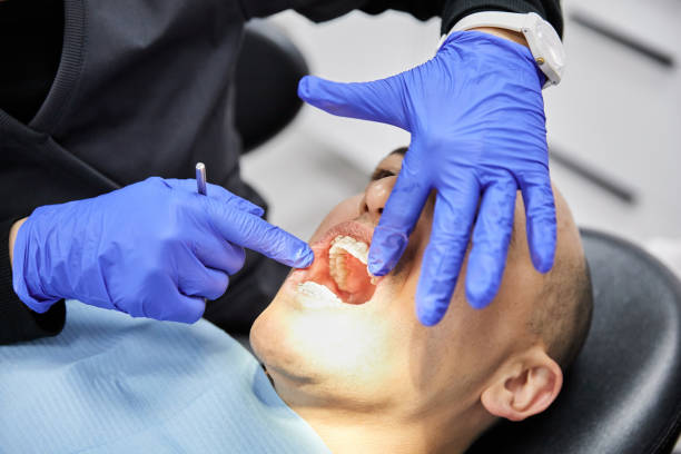 Best Emergency Dental Filling Replacement  in Devola, OH