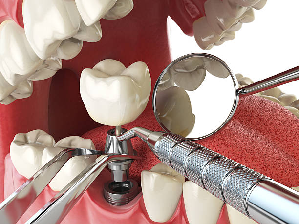 Best Broken Tooth Emergency  in Devola, OH