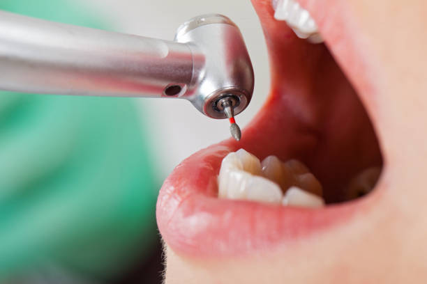 Best Emergency Gum Pain Relief  in Devola, OH